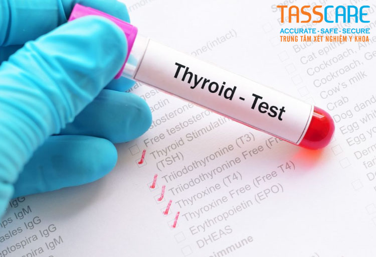 cac-xet-nghiem-tuyen-giap