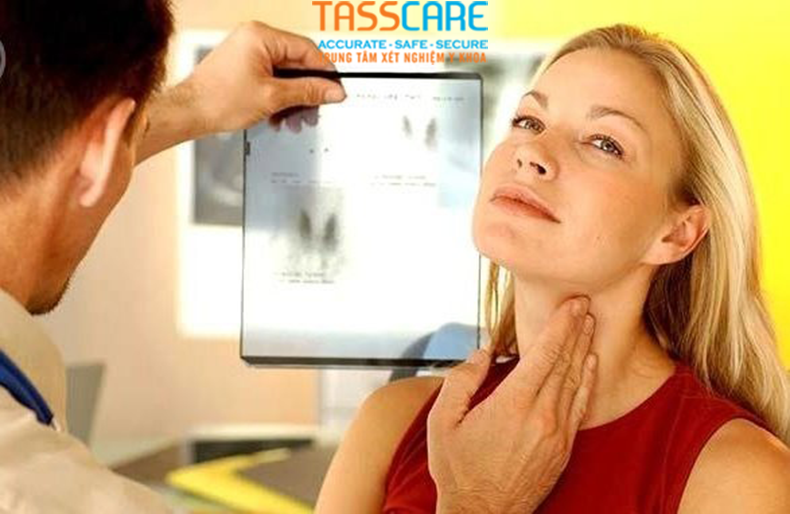 xet nghiem tuyen giap o nu