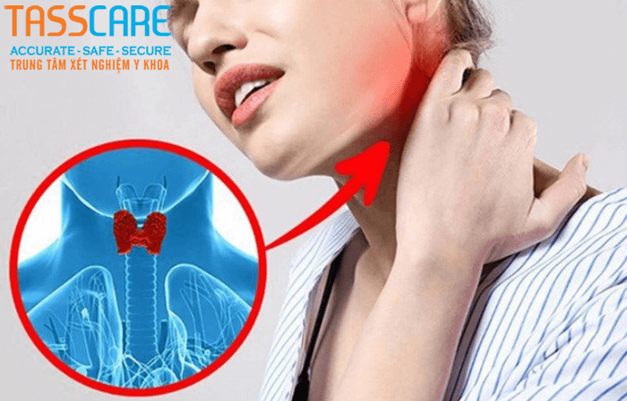 xet-nghiem-tuyen-giap-o-dau