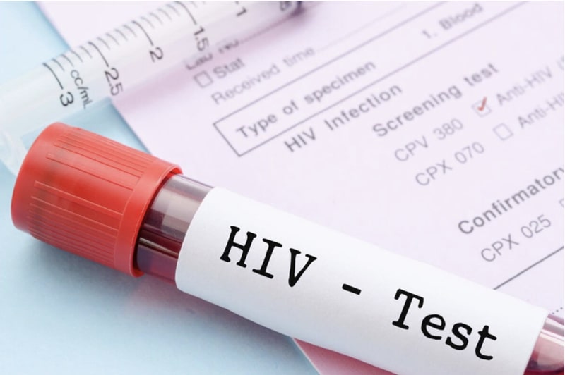 Xét nghiệm HIV có ý nghĩa quan trọng trong việc phát hiện sớm tình trạng nhiễm virus