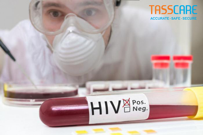 Có trường hợp nào xét nghiệm 3 tháng âm tính 6 tháng dương tính chưa?
