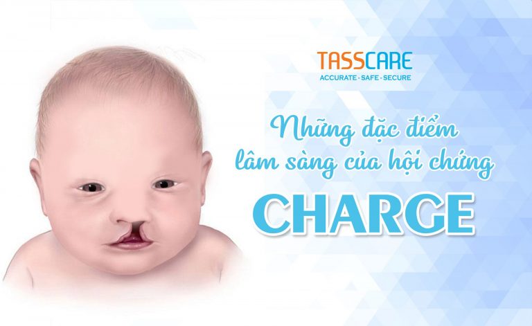 Những đặc điểm lâm sàng của hội chứng CHARGE