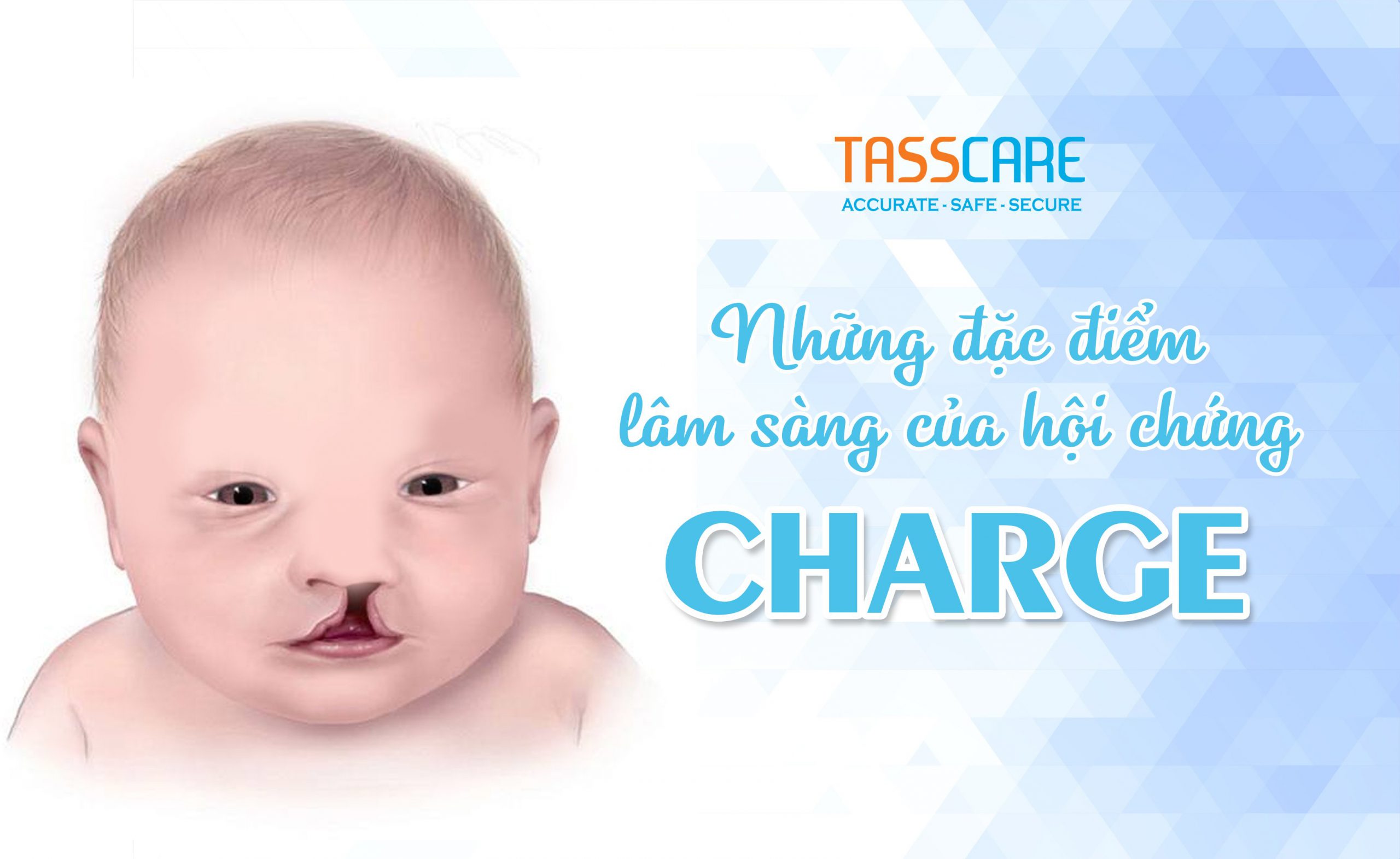 Những đặc điểm lâm sàng của hội chứng CHARGE