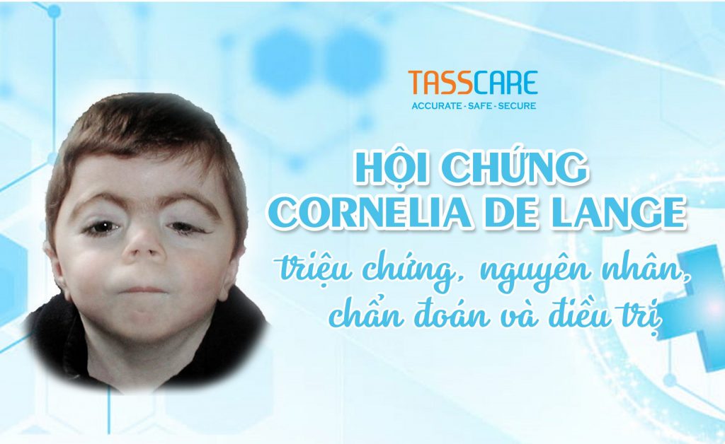 Hội chứng Cornelia de Lange: triệu chứng, nguyên nhân, chẩn đoán và điều trị