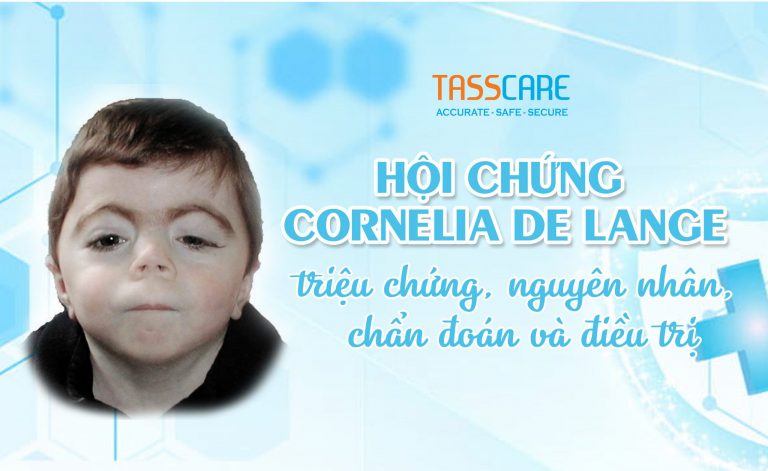 Hội chứng Cornelia de Lange: triệu chứng, nguyên nhân, chẩn đoán và điều trị