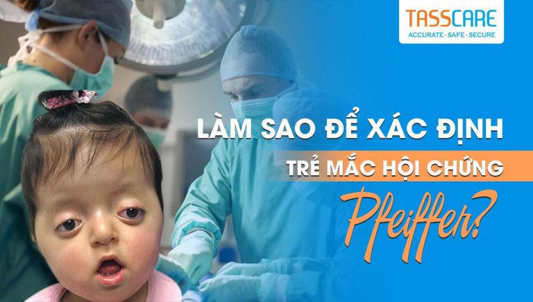 Làm sao để xác định trẻ mắc hội chứng Pfeiffer?