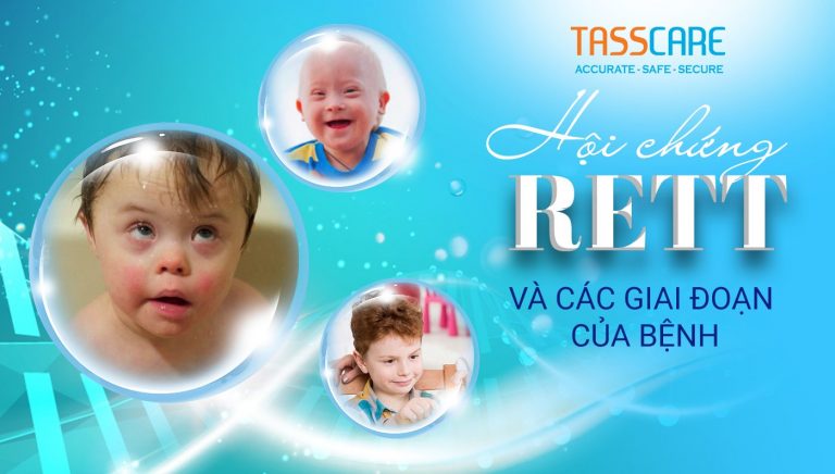 Hội chứng Rett và các giai đoạn của bệnh