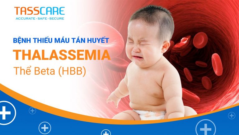 Thiếu máu tán huyết Thalassemia (HBB)