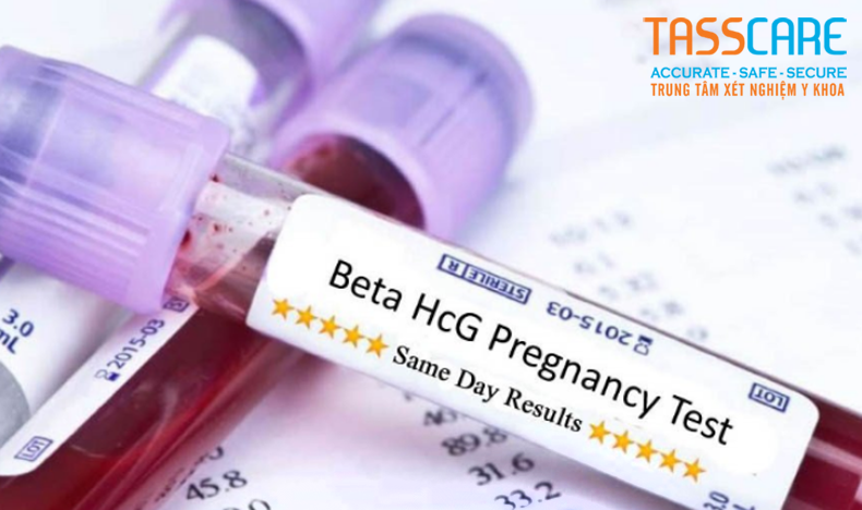 Xet-nghiem-beta-hcg