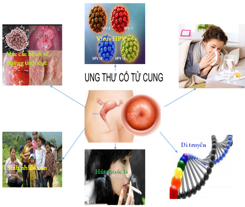 nguyen nhan gay ung thu co tu cung
