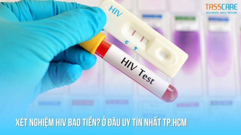 xét nghiệm HIV bao tiền ở đâu uy tín nhất tphcm