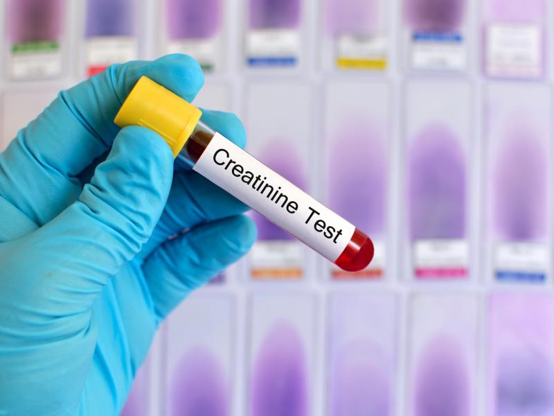 xet-nghiem-mau-creatinine